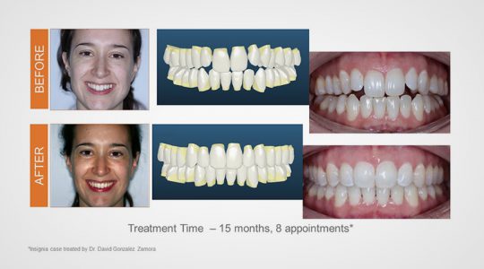 Dr. David Gonzalez Zamora - Madrid, Spain Dr. David Gonzalez Zamora - Madrid, Spain