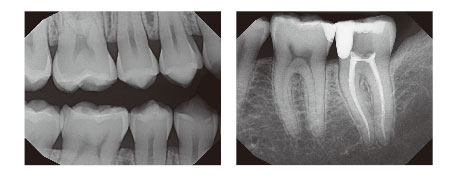 Titaniumの鮮明な画質 Titaniumの鮮明な画質