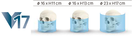 v17の診療領域 v17の診療領域