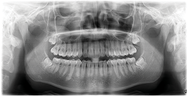 9秒高速スキャン 9秒高速スキャン