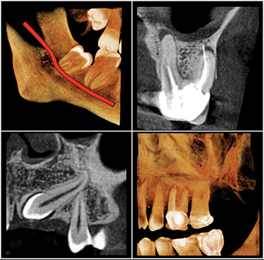 FOV Φ5 × H5cm FOV Φ5 × H5cm