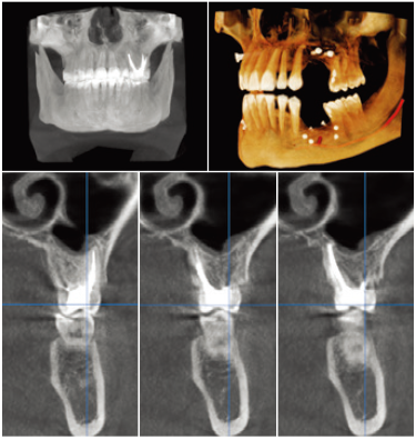 FOV Φ11 × H9cm FOV Φ11 × H9cm