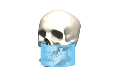 FOV Φ11 × H9cm FOV Φ11 × H9cm