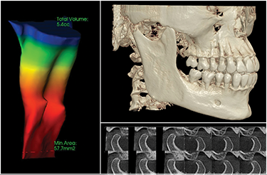 FOV Φ14 × H9cm* FOV Φ14 × H9cm*