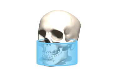 FOV Φ11 × H9cm FOV Φ11 × H9cm