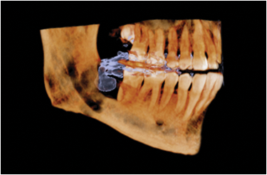FOV Φ9 × H6cm FOV Φ9 × H6cm