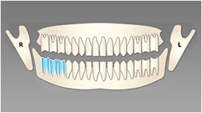 関心領域と連動する3D撮影領域の決定 関心領域と連動する3D撮影領域の決定