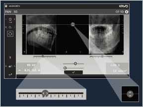 プレビュー機能により正確な位置決めと撮影領域の調整 プレビュー機能により正確な位置決めと撮影領域の調整