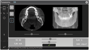 迅速な画像確認 迅速な画像確認