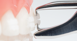 シンメトリークリア シンメトリークリア