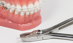 シンメトリークリア シンメトリークリア