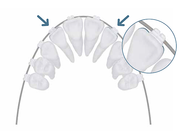 シンメトリークリア シンメトリークリア