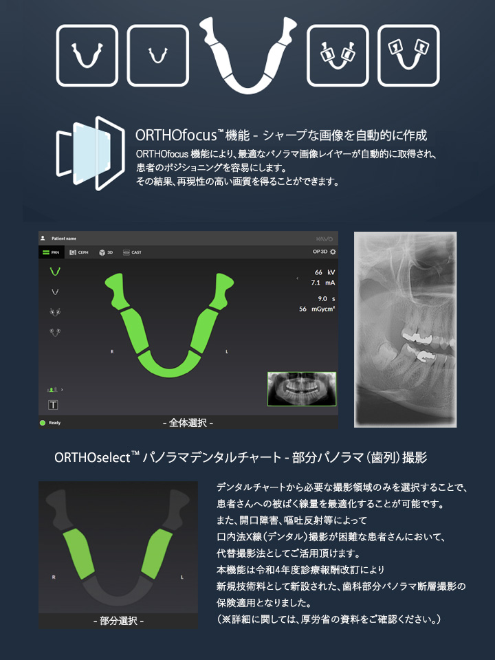 ORTHOfocus™ 機能とORTHOselec™ 機能 ORTHOfocus™ 機能とORTHOselec™ 機能