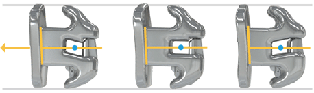 3つのブラケットオプションの写真 3つのブラケットオプションの写真