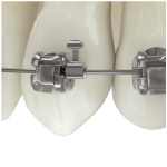 チェアタイムの短縮 チェアタイムの短縮