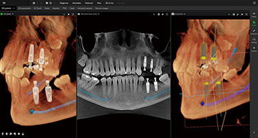 FOV Φ10 × H10cm FOV Φ10 × H10cm