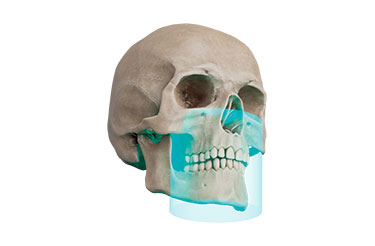 FOV Φ10 × H10cm FOV Φ10 × H10cm