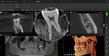 FOV Φ15 × H12cm FOV Φ15 × H12cm