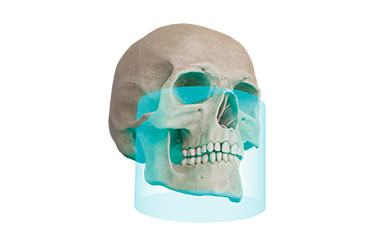 FOV Φ15 × H12cm FOV Φ15 × H12cm