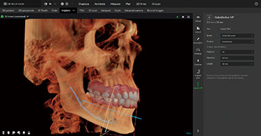 FOV Φ20 × H15cm FOV Φ20 × H15cm