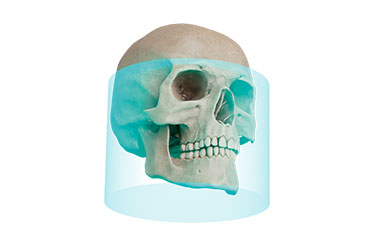 FOV Φ20 × H15cm FOV Φ20 × H15cm