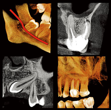 FOV Φ5 × H5cm FOV Φ5 × H5cm