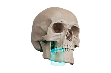 FOV Φ5 × H5cm FOV Φ5 × H5cm