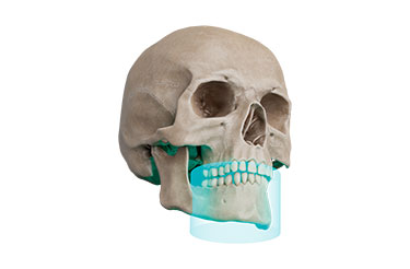 FOV Φ9 × H6cm FOV Φ9 × H6cm