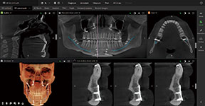 次世代の画質向上テクノロジー 次世代の画質向上テクノロジー