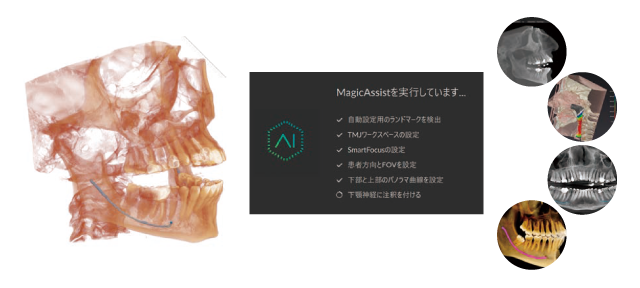 Assisted Intelligence(AI) Assisted Intelligence(AI)