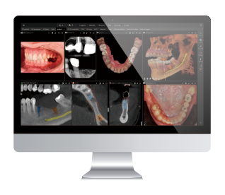 DTX Benefits DTX Benefits