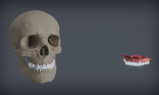 smart fusion smart fusion